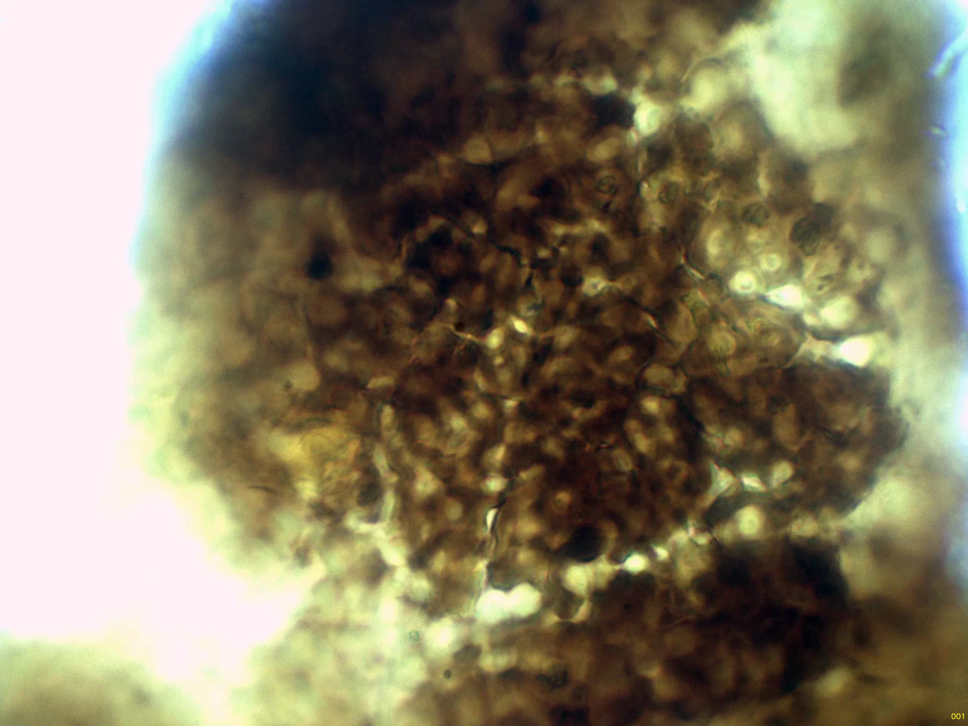 Microscopía de Strangospora pinicola - 10 - Peridio Melzer-001